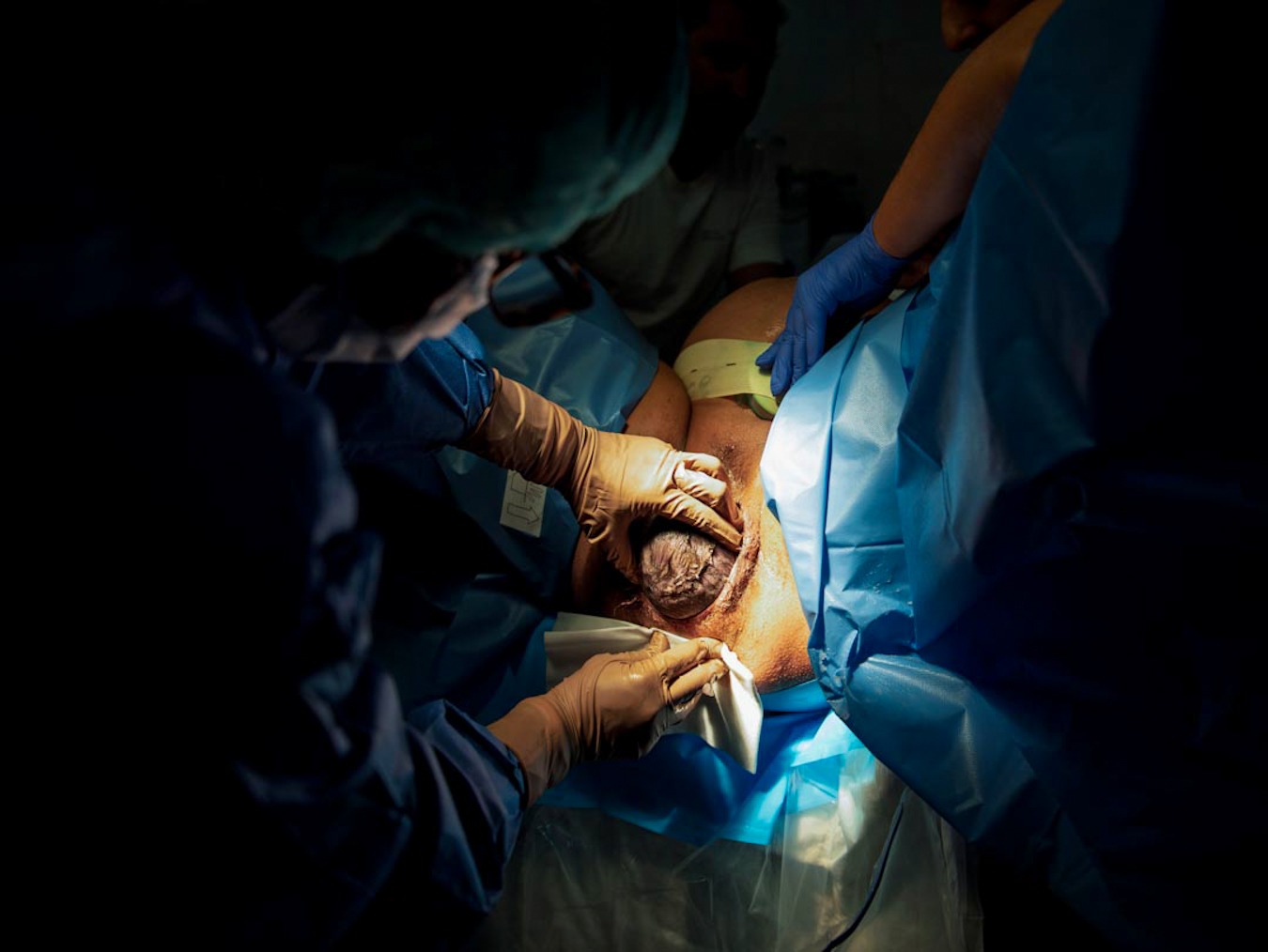 Fotografía de parto en Barcelona (clínica dexeus)