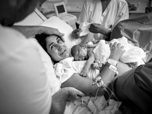 Fotografía de parto en Barcelona | Clínica Dexeus